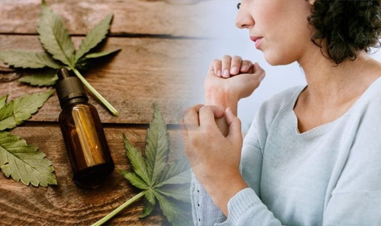 Can CBD creams and oils help to alleviate itchy symptoms of eczema?